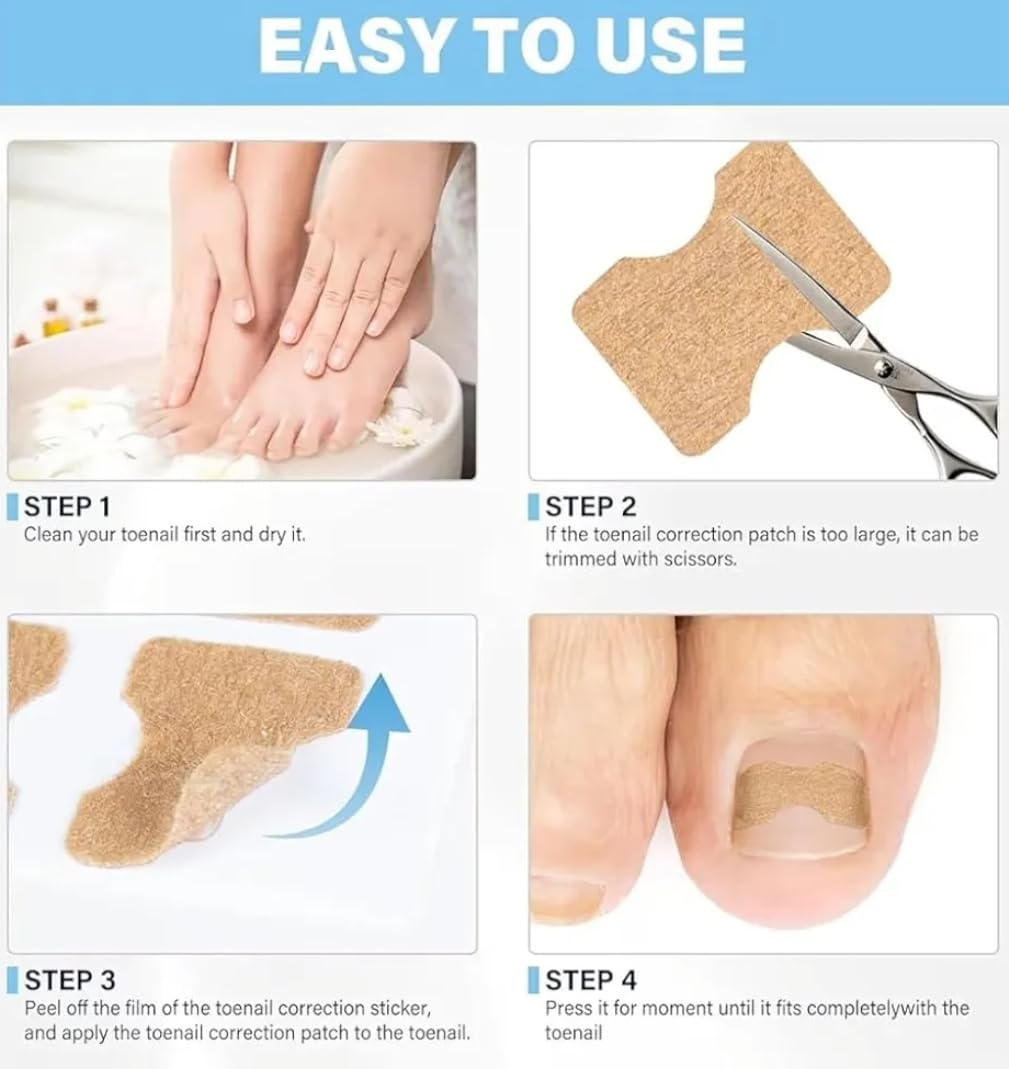 Nail Fix Patches